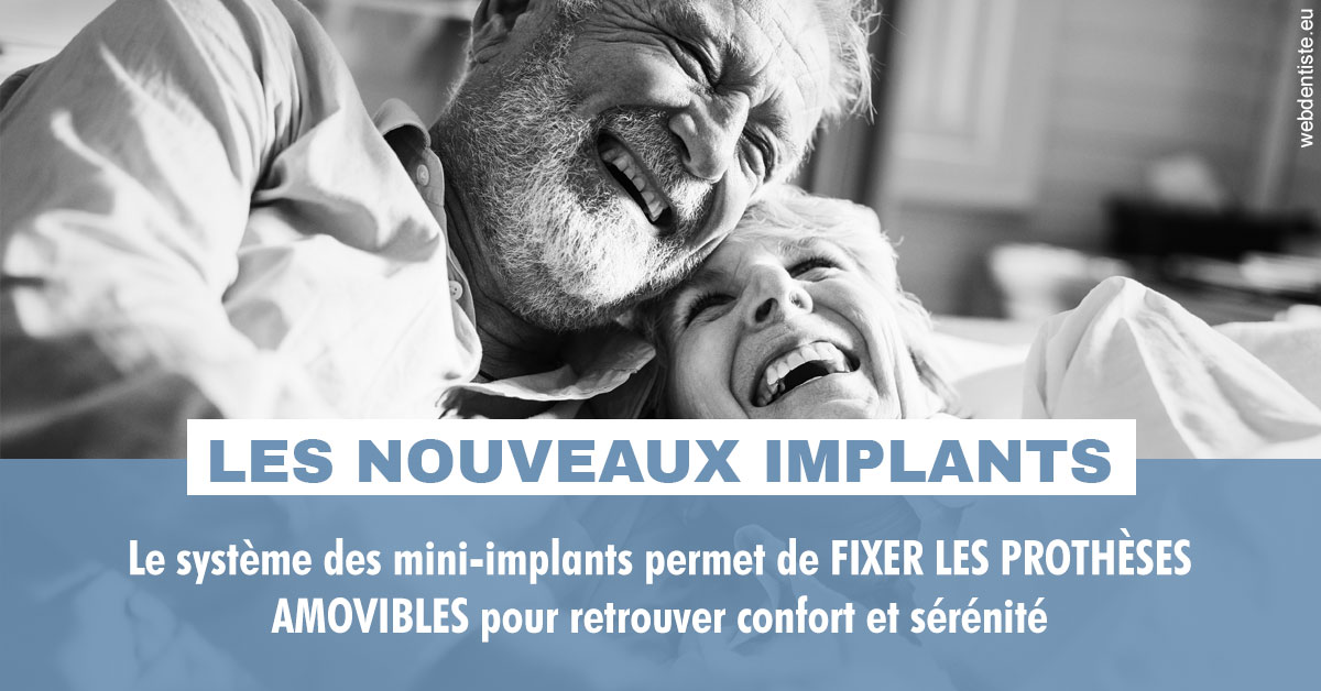 https://dr-edouard-gilles.chirurgiens-dentistes.fr/Les nouveaux implants 2