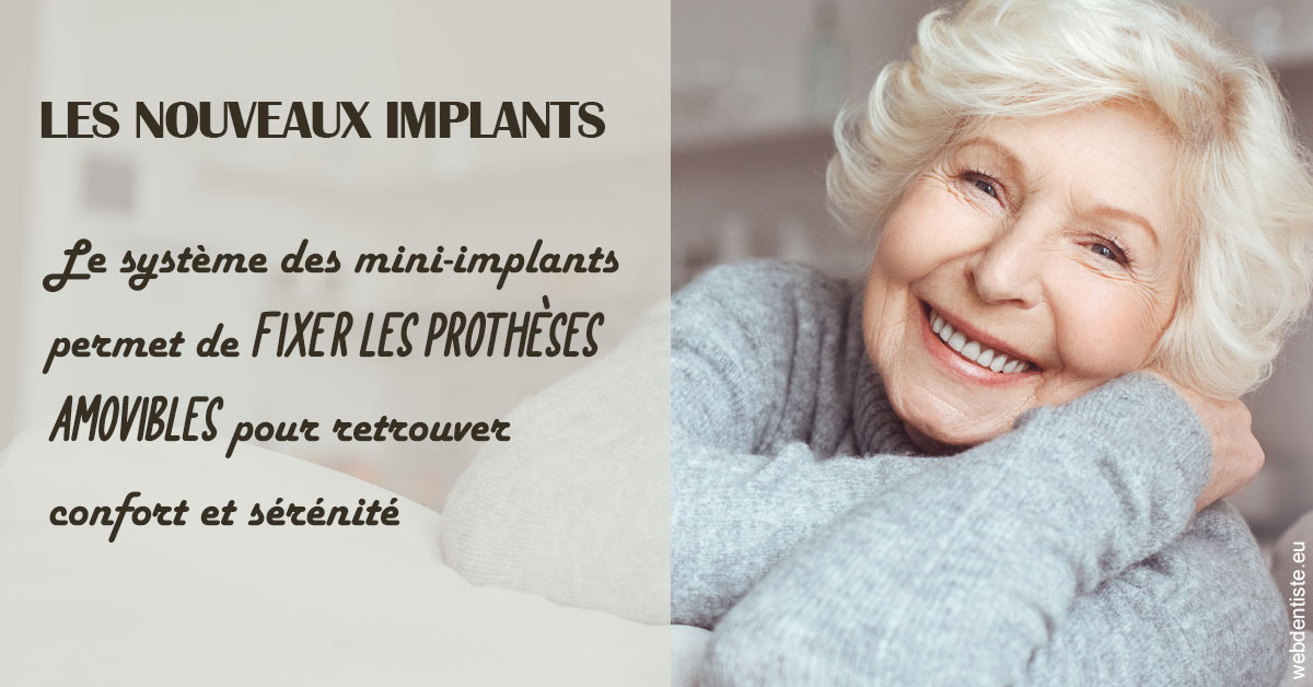 https://dr-edouard-gilles.chirurgiens-dentistes.fr/Les nouveaux implants 1