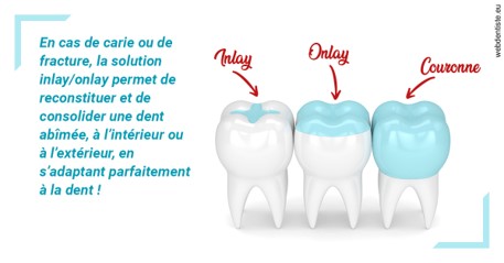 https://dr-edouard-gilles.chirurgiens-dentistes.fr/L'INLAY ou l'ONLAY