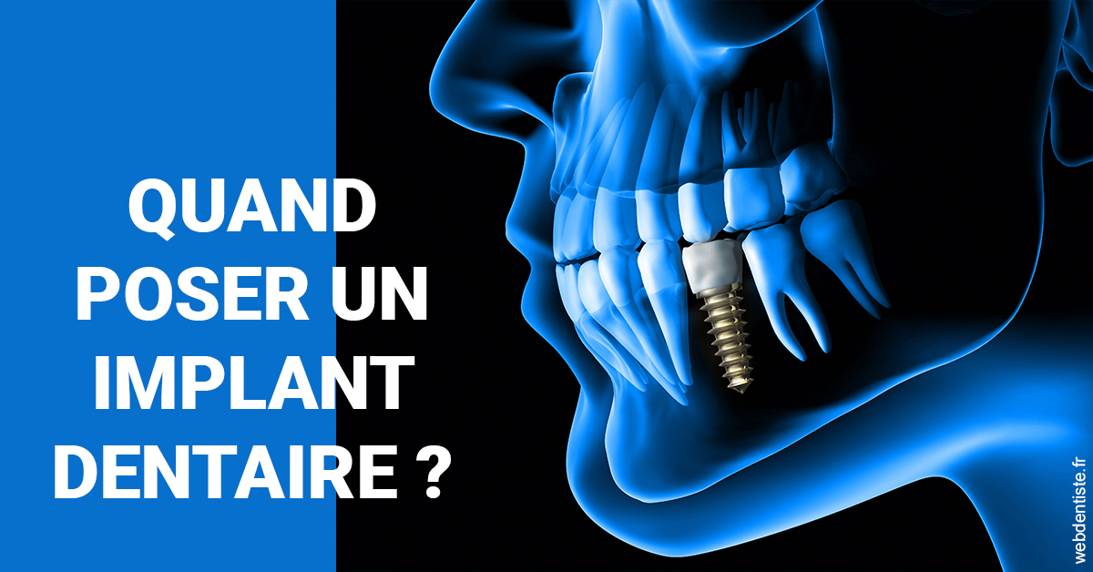 https://dr-edouard-gilles.chirurgiens-dentistes.fr/Les implants 1