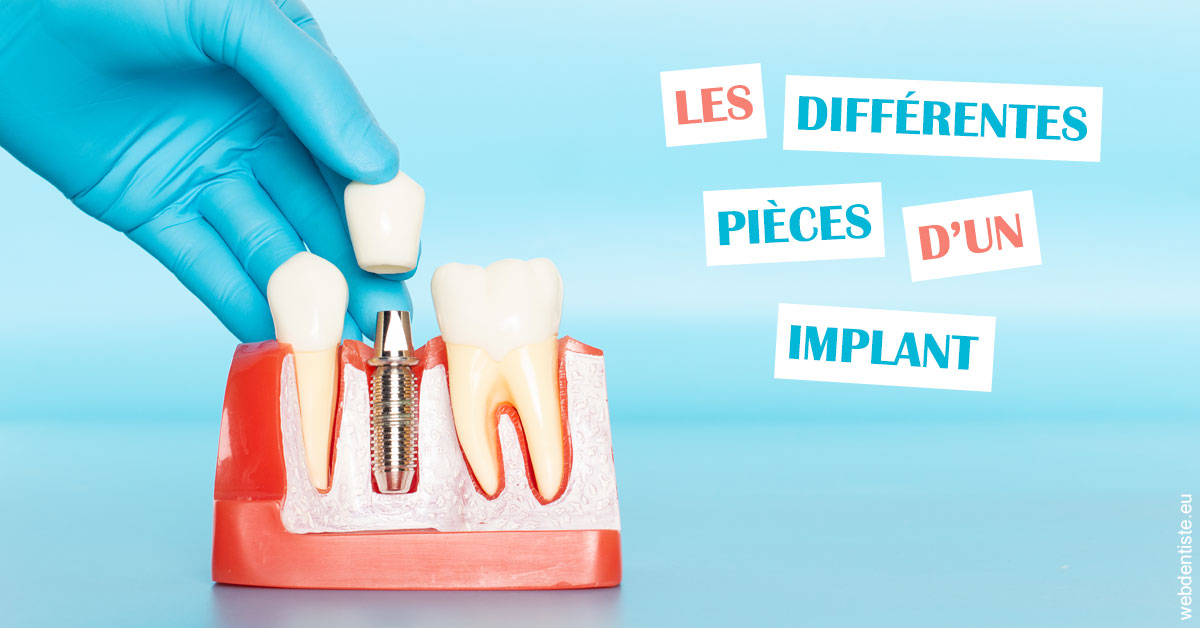https://dr-edouard-gilles.chirurgiens-dentistes.fr/Les différentes pièces d’un implant 2