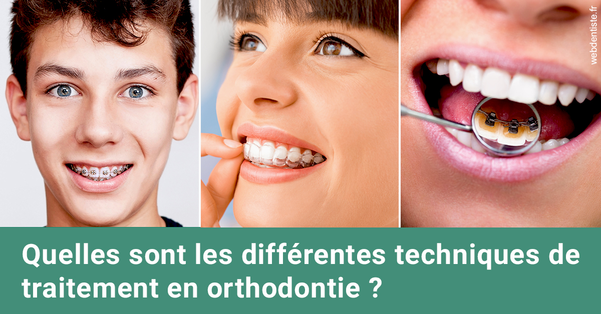 https://dr-edouard-gilles.chirurgiens-dentistes.fr/Les différentes techniques de traitement 2
