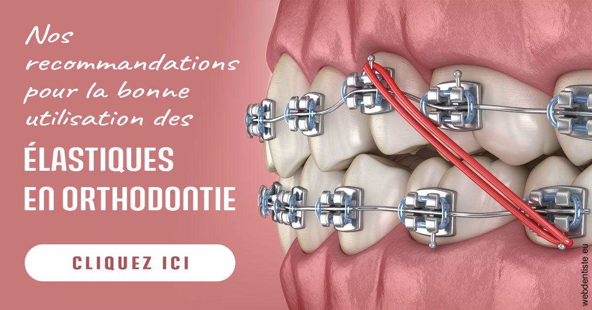 https://dr-edouard-gilles.chirurgiens-dentistes.fr/Elastiques orthodontie 2